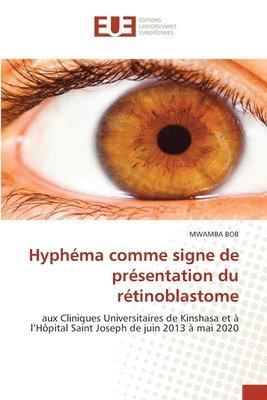 Hyphéma comme signe de présentation du rétinoblastome 1