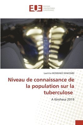 bokomslag Niveau de connaissance de la population sur la tuberculose