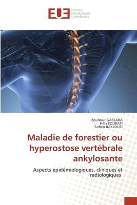 bokomslag Maladie de forestier ou hyperostose vertébrale ankylosante