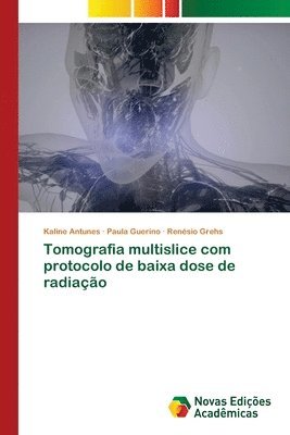 bokomslag Tomografia multislice com protocolo de baixa dose de radiao