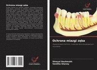 bokomslag Ochrona miazgi z?ba
