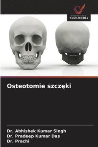 bokomslag Osteotomie szcz?ki
