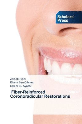 bokomslag Fiber-Reinforced Coronoradicular Restorations