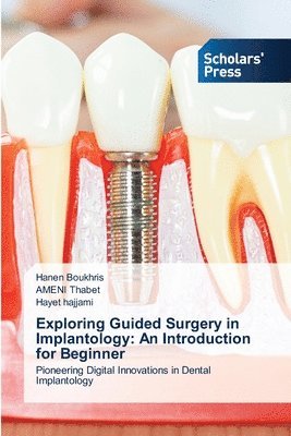 bokomslag Exploring Guided Surgery in Implantology