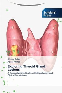 bokomslag Exploring Thyroid Gland Lesions