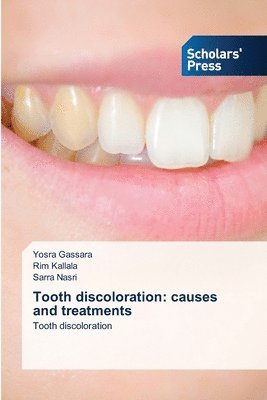 Tooth discoloration 1