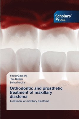 bokomslag Orthodontic and prosthetic treatment of maxillary diastema