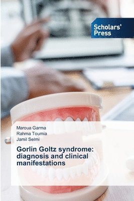 Gorlin Goltz syndrome 1