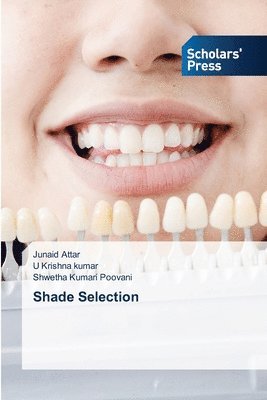 Shade Selection 1