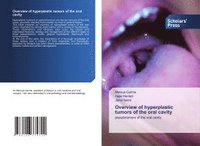 bokomslag Overview of hyperplastic tumors of the oral cavity