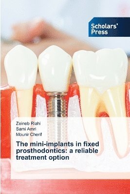 bokomslag mini-implants in fixed prosthodontics