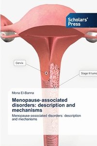 bokomslag Menopause&#8208;associated disorders: description and mechanisms