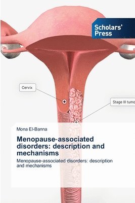 bokomslag Menopause&#8208;associated disorders