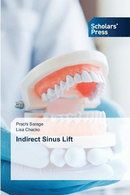 bokomslag Indirect Sinus Lift