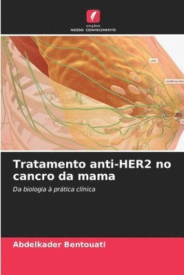 Abdelkader Bentouati - Tratamento anti-HER2 no cancro da mama, Häftad
