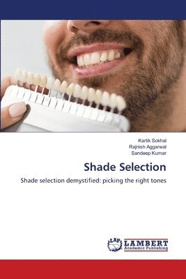 Shade Selection 1