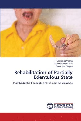 bokomslag Rehabilitation of Partially Edentulous State