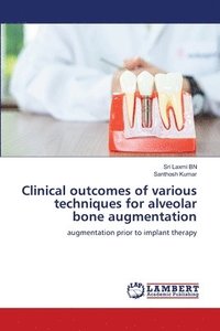 bokomslag Clinical outcomes of various techniques for alveolar bone augmentation