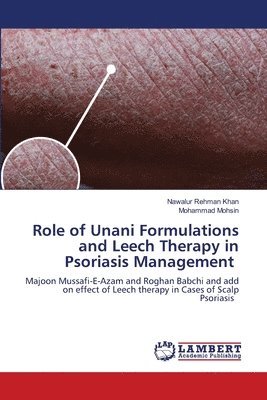 Role of Unani Formulations and Leech Therapy in Psoriasis Management 1