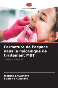 bokomslag Fermeture de l'espace dans la mécanique de traitement MBT
