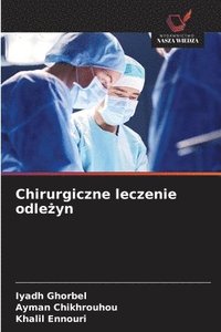 bokomslag Chirurgiczne leczenie odle?yn