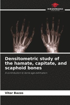 bokomslag Densitometric study of the hamate, capitate, and scaphoid bones