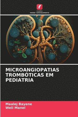 Microangiopatias Trombóticas Em Pediatria