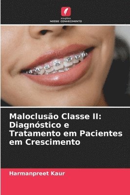 Harmanpreet Kaur - Maloclusão Classe II: Diagnóstico e Tratamento em Pacientes em Crescimento, Häftad