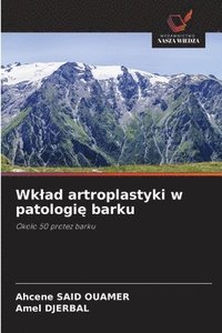 bokomslag Wklad artroplastyki w patologi? barku
