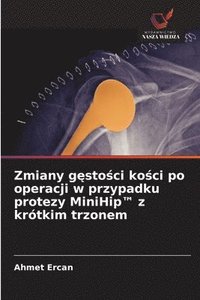 bokomslag Zmiany g¿sto¿ci ko¿ci po operacji w przypadku protezy MiniHip(TM) z krótkim trzonem