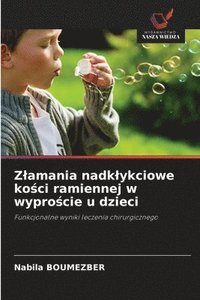 bokomslag Zlamania nadklykciowe ko?ci ramiennej w wypro?cie u dzieci