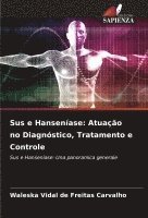 bokomslag Sus e Hanseníase: Atuação no Diagnóstico, Tratamento e Controle