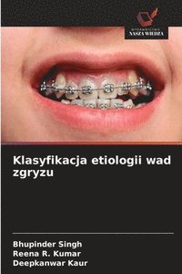 bokomslag Klasyfikacja etiologii wad zgryzu