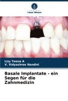 bokomslag Basale Implantate - ein Segen für die Zahnmedizin