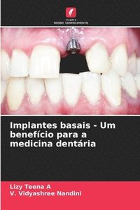 bokomslag Implantes basais - Um benefício para a medicina dentária