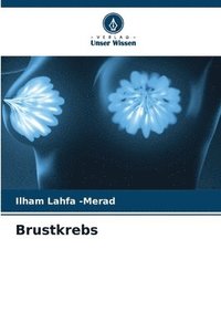bokomslag Brustkrebs