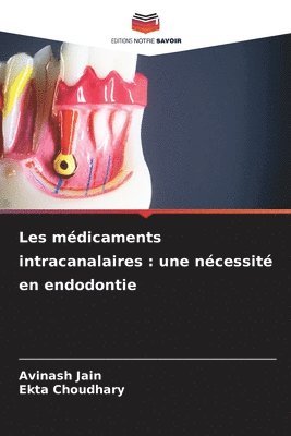Avinash Jain, Ekta Choudhary - Les médicaments intracanalaires, Häftad