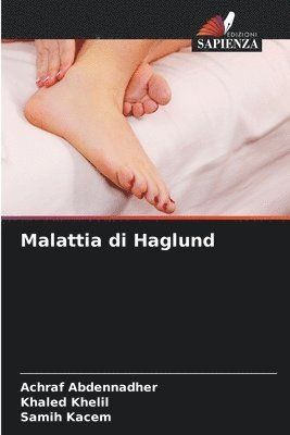 Malattia di Haglund 1