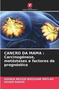 bokomslag Cancro Da Mama