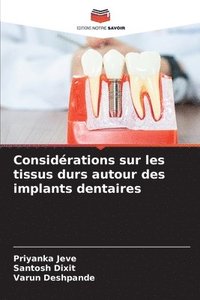 bokomslag Considrations sur les tissus durs autour des implants dentaires