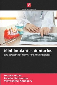bokomslag Mini implantes dentrios