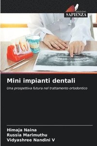 bokomslag Mini impianti dentali