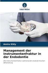 bokomslag Management der Instrumentenfraktur in der Endodontie