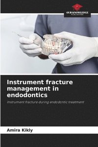 bokomslag Instrument fracture management in endodontics