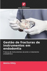 bokomslag Gesto de fracturas de instrumentos em endodontia