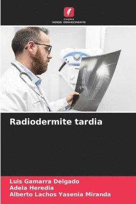 Radiodermite tardia 1