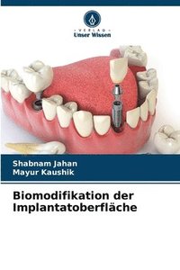 bokomslag Biomodifikation der Implantatoberfläche