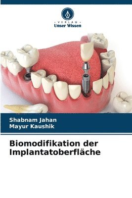bokomslag Biomodifikation der Implantatoberfläche