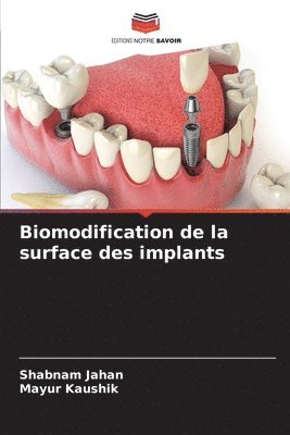 bokomslag Biomodification de la surface des implants
