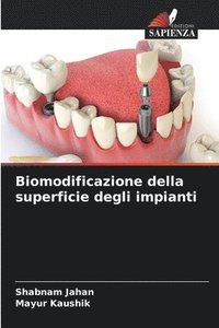 bokomslag Biomodificazione della superficie degli impianti